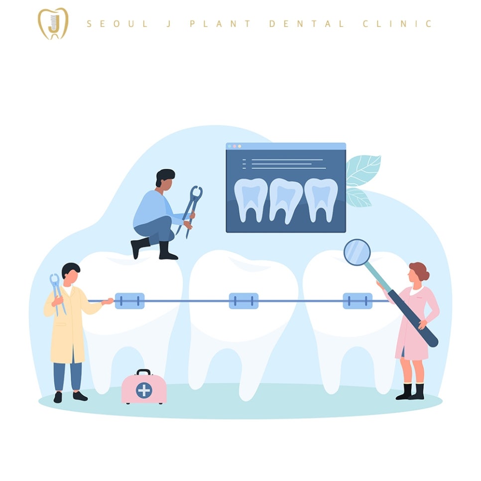 미아동치과-서울J플란트치과-치아 교정을 나타내는 일러스트